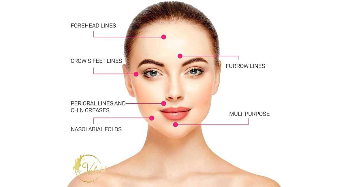 Anti-wrinkle-Injection Anti-wrinkle-Injection