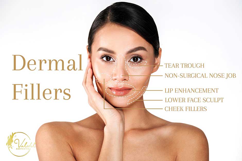 Dermal Fillers Dermal Fillers