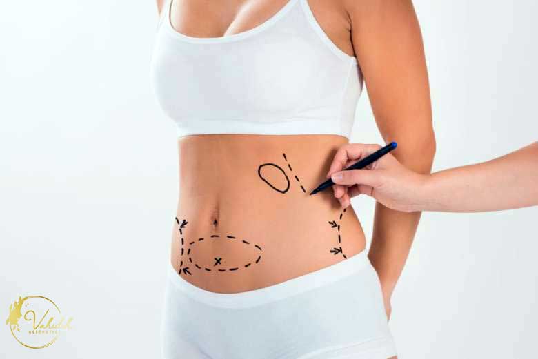 Fat-Dessolving-Injection Fat Dessolving Injection