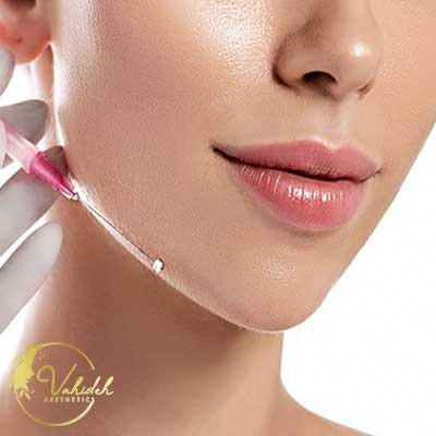 Mono Collagen thread