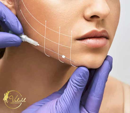 PDO-Thread-lift-(Neck-&-Face) PDO-Thread-lift-(Neck-&-Face)