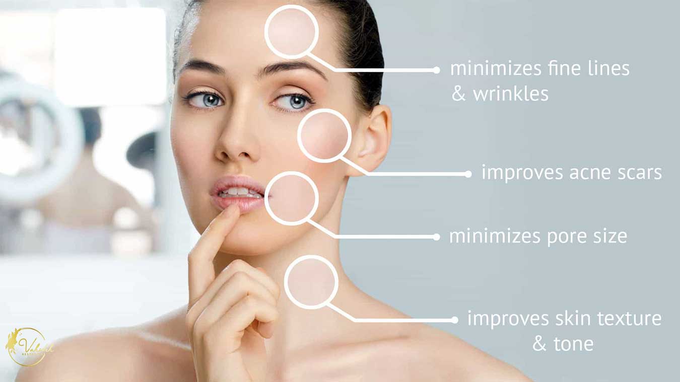 Skin Booster Skin Booster