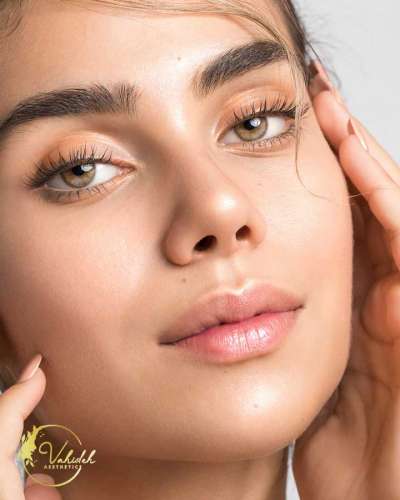 chin-after-dermal-filler chin-after-dermal-filler