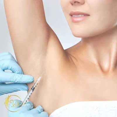 hyperhidrosis-botox