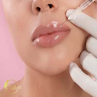 lip filler