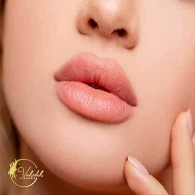 russian lip filler