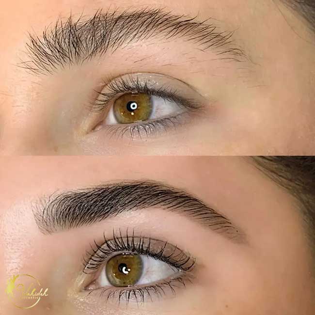 Eyebrow eyebrow-lift