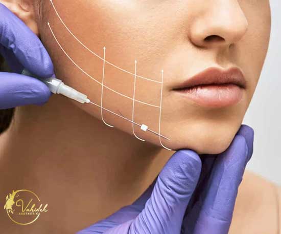 PDO-Thread-lift-(Neck-&-Face)