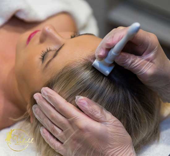 micro-needling-hair-loss-toronto micro-needling-hair-loss-toronto