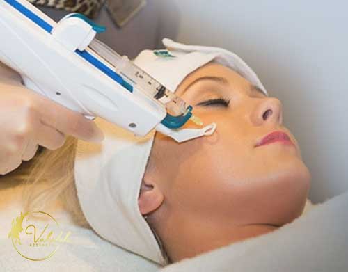 mesotherapy mesotherapy
