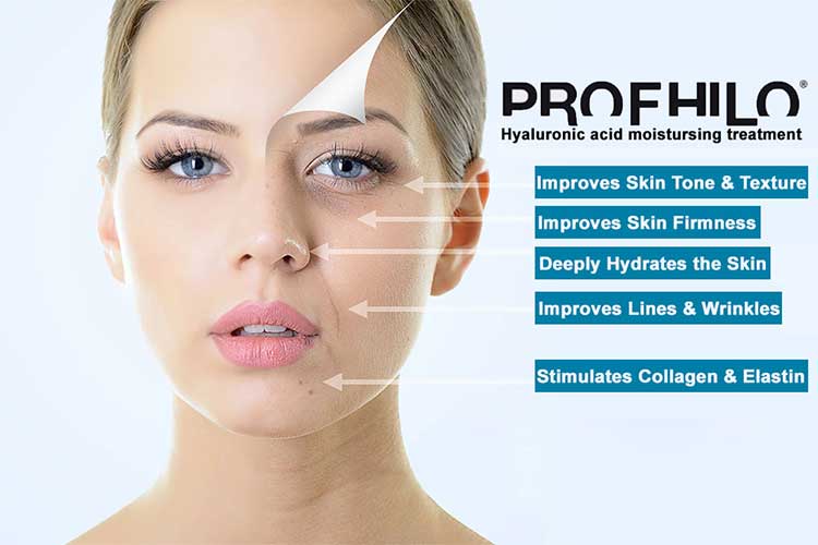 profhilo profhilo