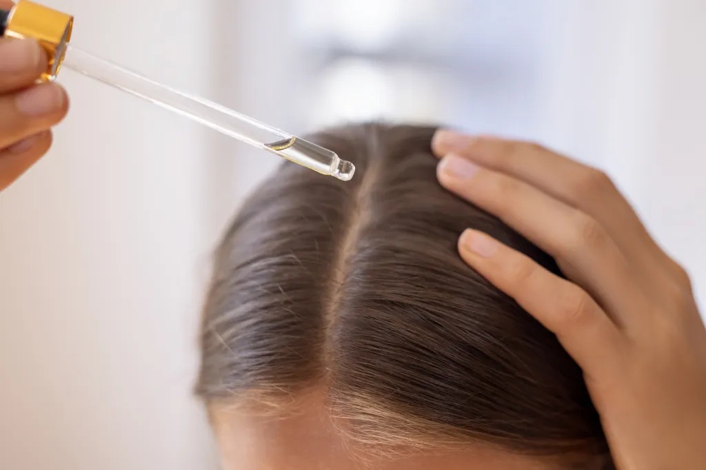 Hair Loss Treatments