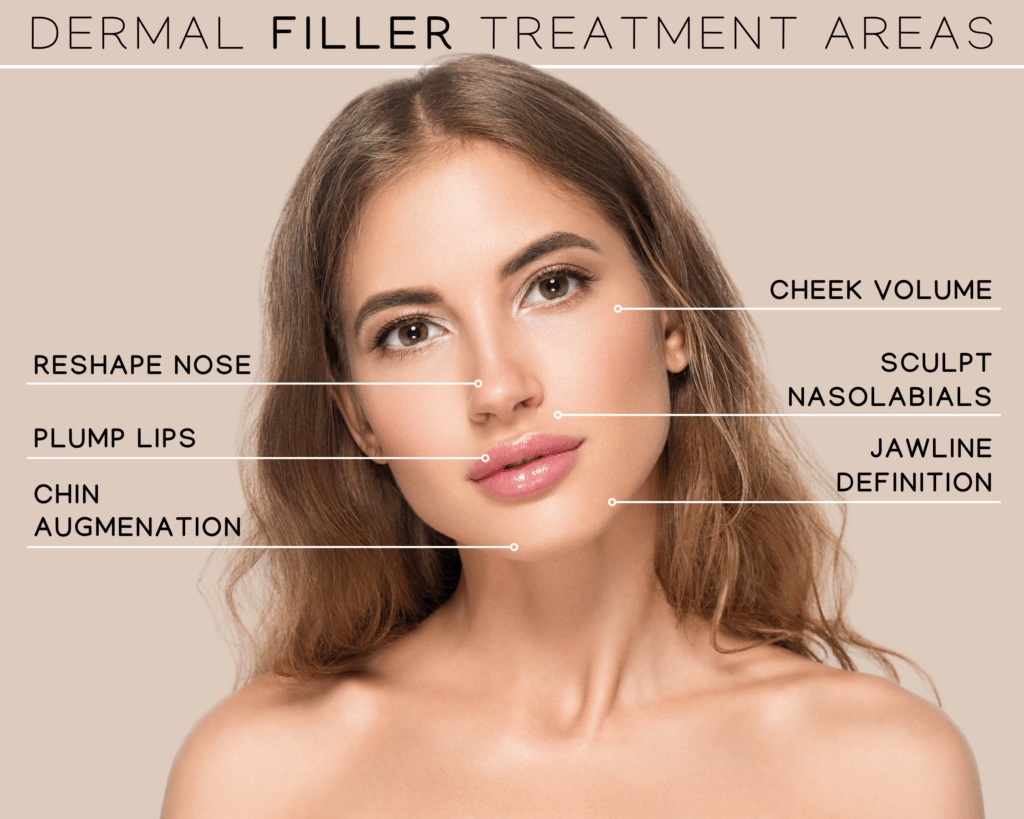 Dermal Fillers