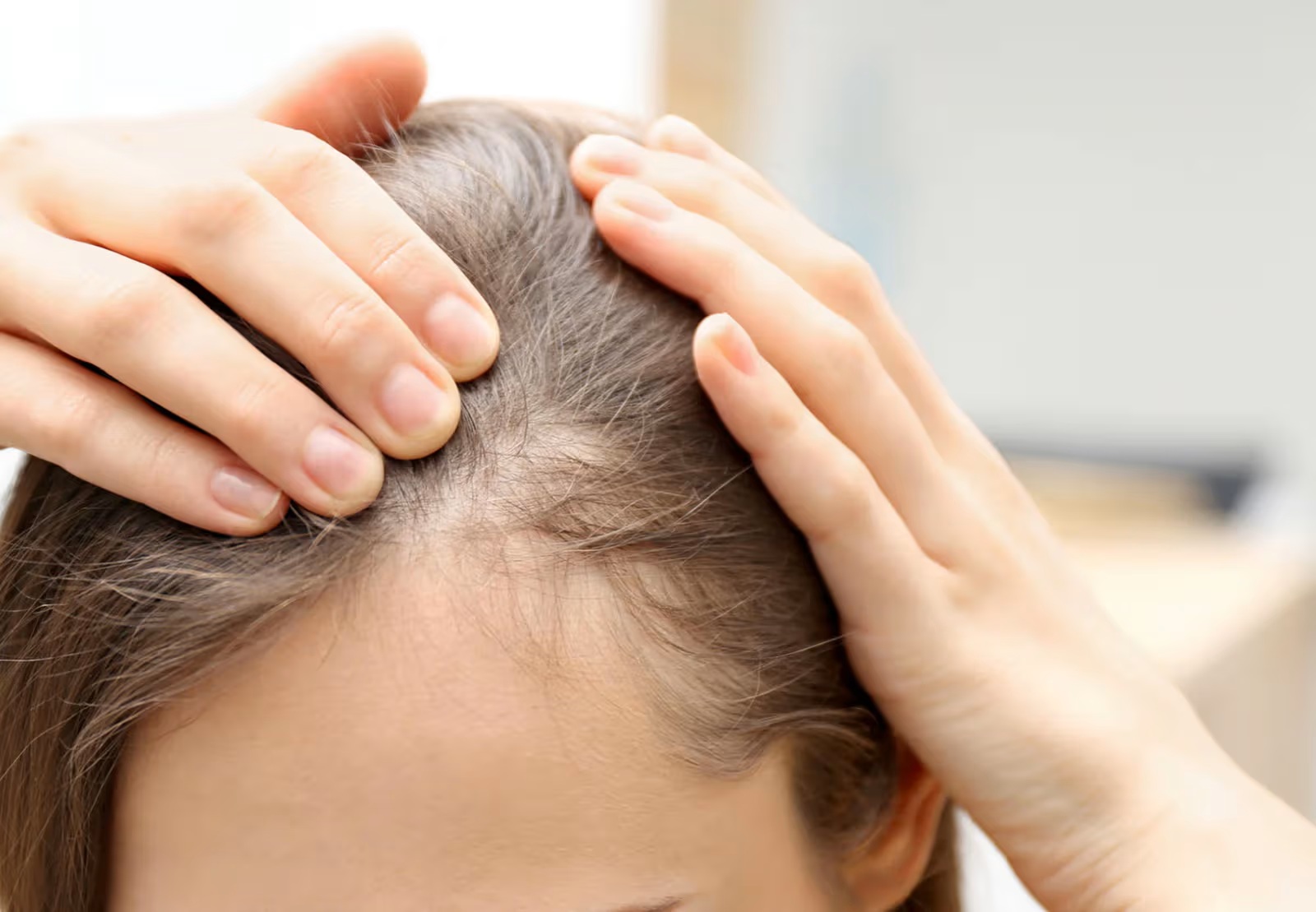 Hair Loss Treatments